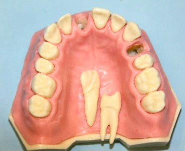 Modelo anatómico de maxilar - APIC-1  - Selmodels SL - de dientes / para extracción dental