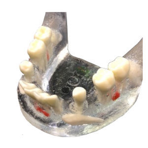 Modelo anatómico de mandíbula - APIC-3 - Selmodels SL - de dientes / para extracción dental / transparente