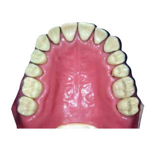 Modelo anatómico de maxilar - DM 128 - Selmodels SL - de dientes / para periodoncia / de enfermedades de los dientes