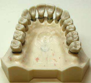 Modelo anatómico de hueso - DM 127 - Selmodels SL - de dientes / para periodoncia / de enfermedades de los dientes