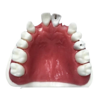 Modelo anatómico de maxilar - SS – 101  - Selmodels SL - de canal radicular / de formación / para sutura