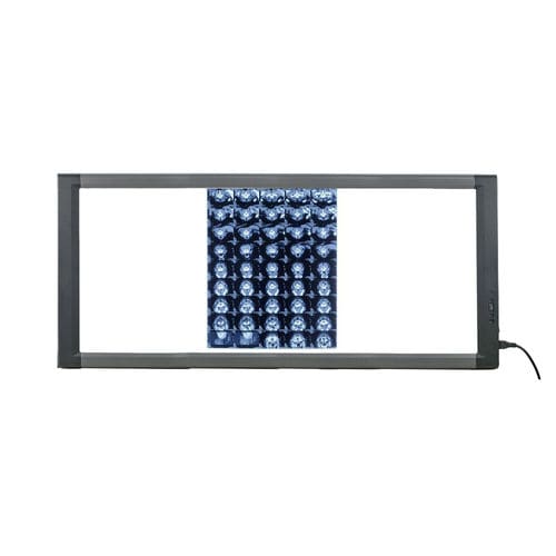 Negatoscopio digital - MG03 - Nanchang Micare Medical Equipment - 3 pantallas / con interruptor / LED