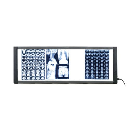 Negatoscopio digital - MG04 - Nanchang Micare Medical Equipment - 4 pantallas / con interruptor / LED