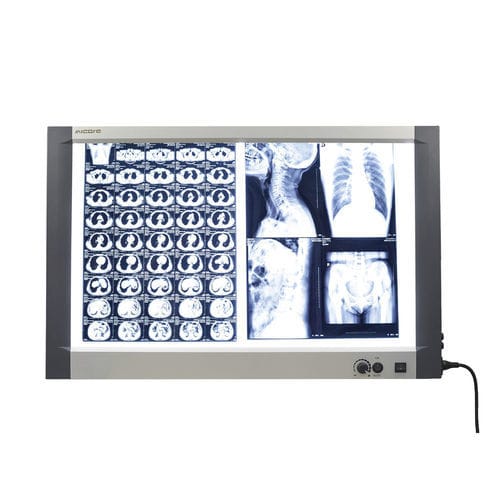 Negatoscopio 2 pantallas - MG-02X - Nanchang Micare Medical Equipment - de luz blanca / con interruptor / para mamografía