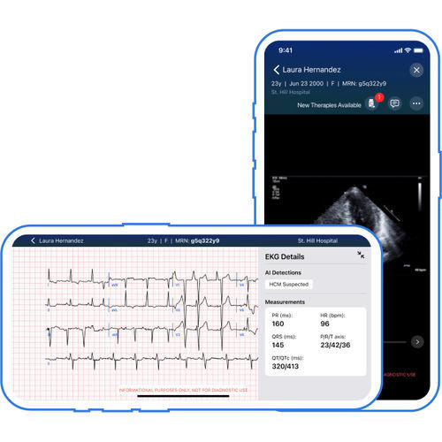 Aplicación para móviles de tratamiento - Viz.ai - para informes / de diagnóstico / para ECG