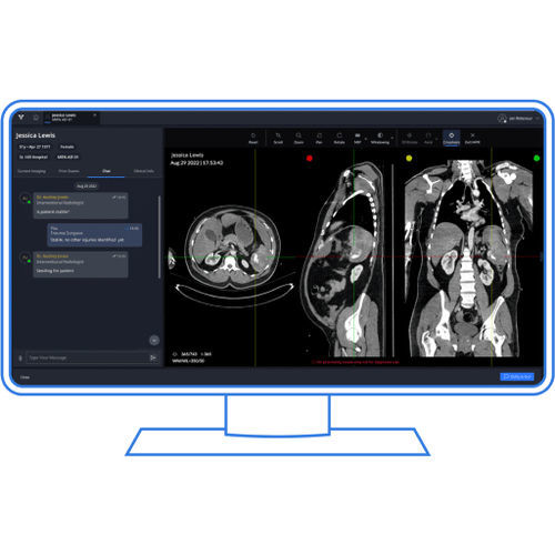 Software para traumatología - Viz.ai - para informes / visualizador / de intercambio