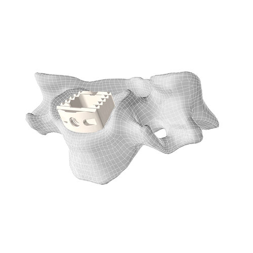 Caja intersomática cervical - CL5™ - Corelink Surgical - vía anterior / de PEEK