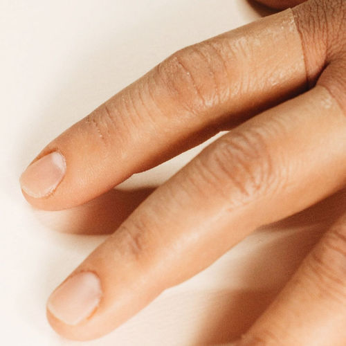 Prótesis estética esterna de dedo - MasCapacidad - para adulto