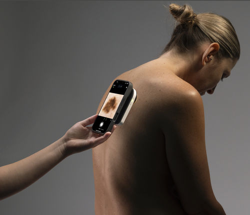 Dermatoscopio LED blanca - VEOS® - CANFIELD