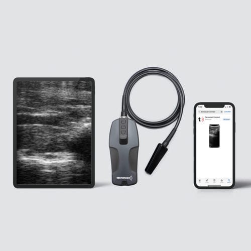 Ecógrafo veterinario portátil - BL Tecnoscan - Tecnovet - multifuncional / sonda inalámbrica
