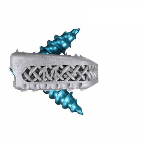 Caja intersomática cervical - Magnolis® Z - Maxxspine Innovative - vía anterior