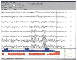 Software de análisis - SleepSign™ - Muromachi Kikai - para EMG / para clínica veterinaria