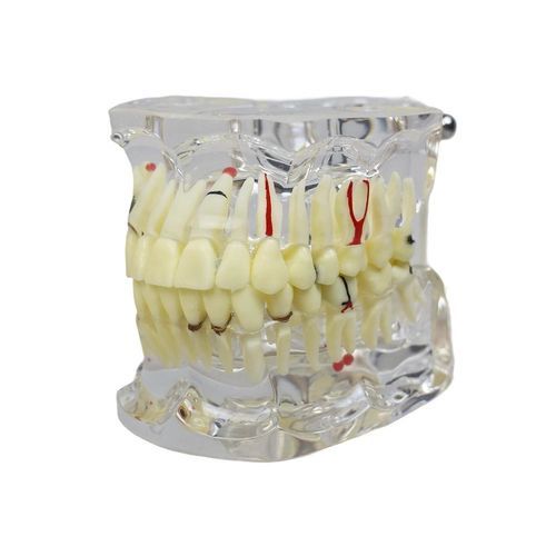 Modelo anatómico de dentadura - JG-Y15-IM - FOSHAN JINGLE MEDICAL EQUIPMENT CO., LTD - de canal radicular / para odontología / de resina