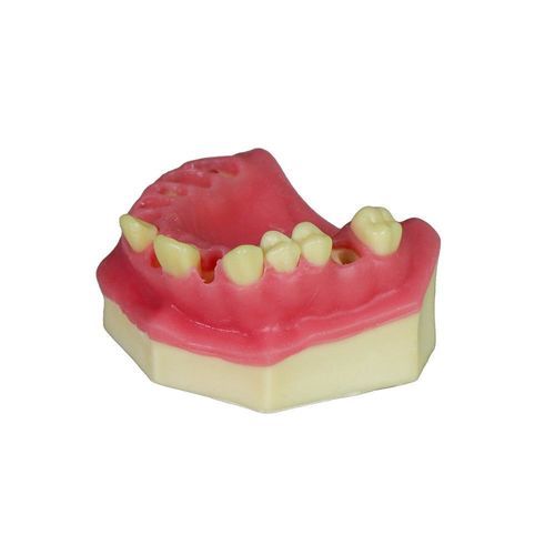 Modelo anatómico gingival - JG-Y8-F3 - FOSHAN JINGLE MEDICAL EQUIPMENT CO., LTD - de hueso / quirúrgico / de formación