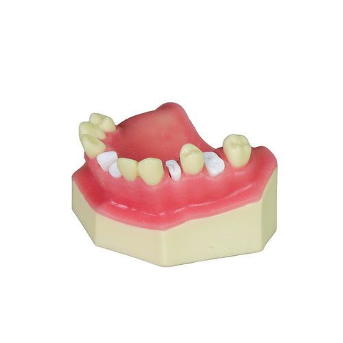 Modelo anatómico de seno - JG-Y8-F5 - FOSHAN JINGLE MEDICAL EQUIPMENT CO., LTD - para odontología / de encías / de maxilar
