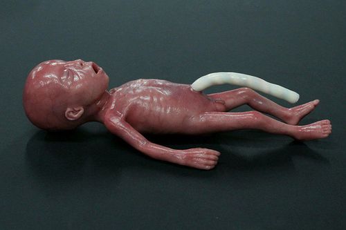 Maniquí de prácticas para atención pediátrica - MICRO-PREEMIE - LifeCast Body Simulation Ltd - de neumotórax / de bebé / de silicona