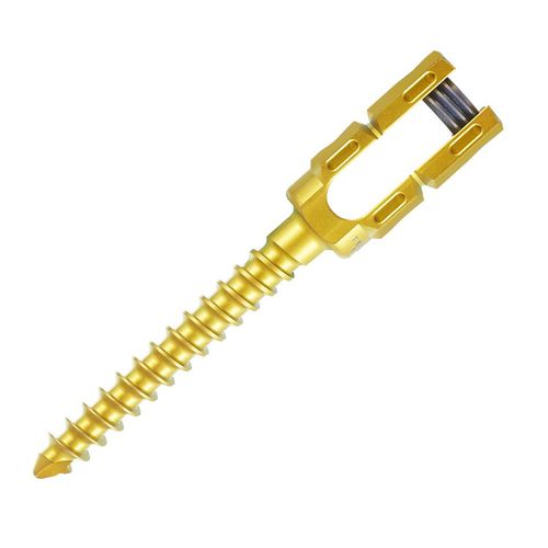 Tornillo pedicular para vértebra torácica, lumbar - 0306-4520 - SurgTech - para vértebra lumbar / monoaxial / metálico