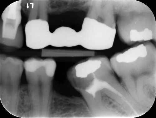 Software de detección de caries - ORCA DENTAL AI - de análisis de imágenes / de diagnóstico / clínico
