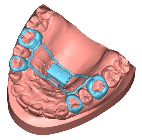 Software de diseño - APPLIANCE - Coruo - de simulación en 3D / de impresión 3D / de laboratorio dental