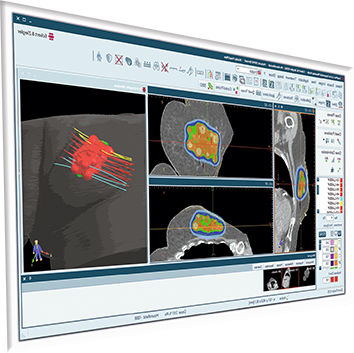 Software de planificación de tratamiento - SagiPlan® - BEBIG MEDICAL GmbH - de evaluación / TDM / para IRM