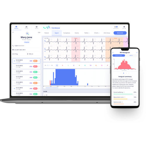 Software de análisis - Cardiolyse - de gestión / de control / para informes