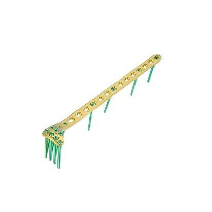 Placa de compresión para tibia - Wuhan Yijiabao Biological Materials - porción proximal / lateral / bloqueada