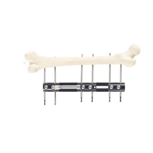 Fijador externo para tibia - Wuhan Yijiabao Biological Materials - para radio / tubular / para adulto