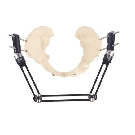 Fijador externo de pelvis - Wuhan Yijiabao Biological Materials - tubular / para adulto