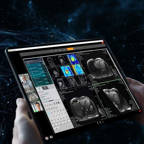 Sistema de gestión y comunicación de visualización - uOmniscan - Shanghai United Imaging - de archivo DICOM / para PACS / de vídeo