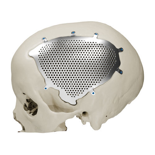 Implante craneal a medida - Craniotech