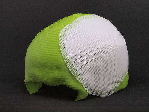 Implante craneal reabsorbible - Osteoplug™ - Osteopore International