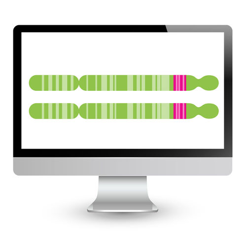 Analizador de biología molecular para el diagnóstico de la FSHD - EnFocus™ - Bionano Genomics