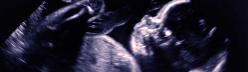 Software de análisis - Congenica Prenatal™ - Congenica Ltd - de diagnóstico / médico / clínico