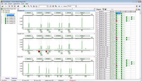 Software de análisis del quimerismo - ChimerMarker® - SoftGenetics, LLC. - de análisis / de monitorización / de laboratorio