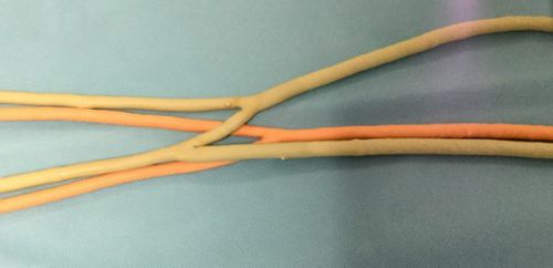 Modelo anatómico de arteria - SimuVasc - de vena / para acceso vascular / de fístula