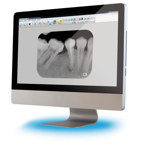 Software para imagen dental - Apixia - visualizador / de tratamiento / para odontología