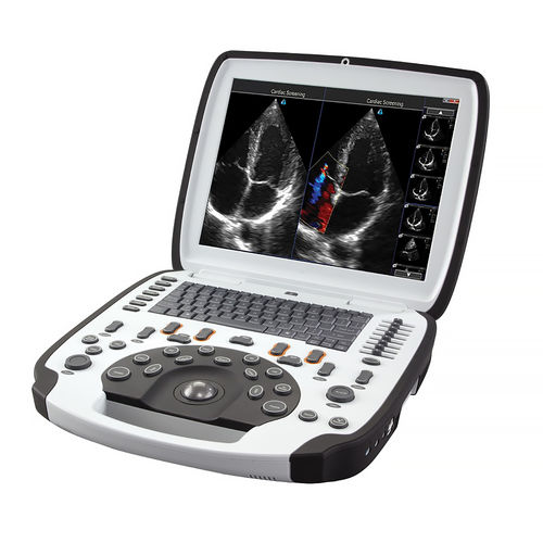 Ecógrafo portátil - uSmart3300 NexGen - DELBio - para ecografía polivalente / blanco y negro / doppler-color