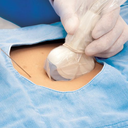 Funda de protección para sonda de ecografía - DUC8 series - Fairmont Medical