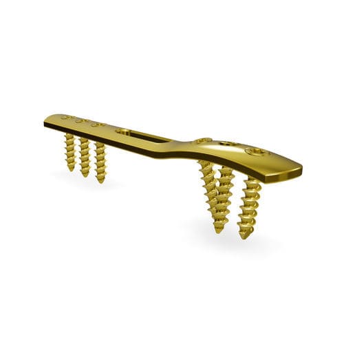 Placa de compresión para maléolo - Malleolus 3.5 locking compression plate - Astrolabe - porción distal / lateral / bloqueada