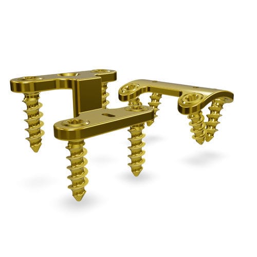 Placa de compresión para metatarso - Rearfoot 3.5 system - Astrolabe - lateral / porción medial / bloqueada