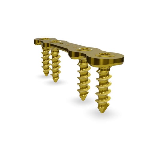 Placa de artrodesis para hallux valgus - Lapidus APP - Astrolabe - plantar / bloqueada / de titanio