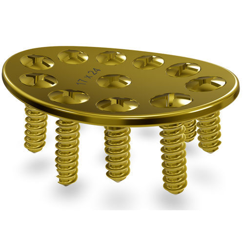 Placa de artrodesis para carpo - CMS 2.3 Modular System - Astrolabe - porción medial / bloqueada / de titanio