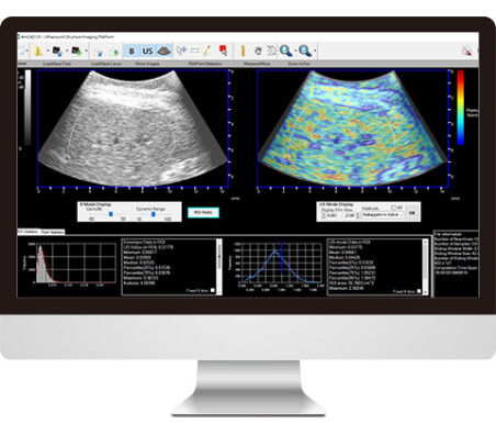 Software para ecografía - AmCAD-US - AmCad BioMed - de visualización / de diagnóstico / de interpretación