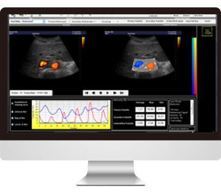 Software de análisis de imágenes - AmCAD-UV  - AmCad BioMed - de interpretación / para ecografía / de vasos sanguíneos