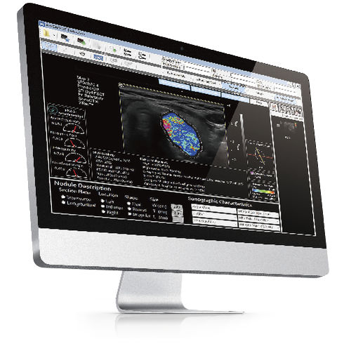 Software para ecografía - AmCAD-UT® - AmCad BioMed - de análisis de imágenes / de gestión / para informes