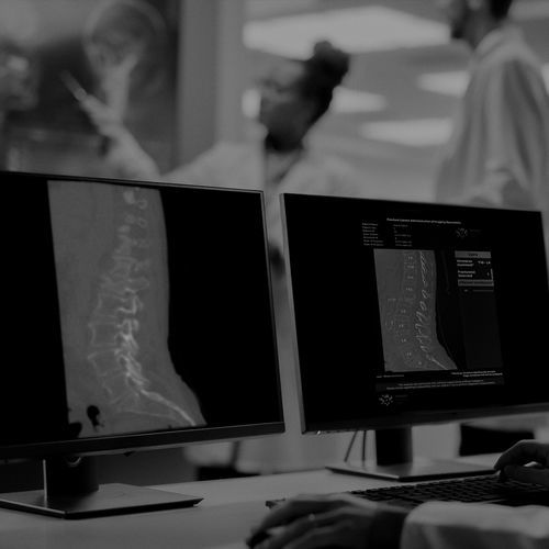 Software de detección de fracturas - IB Lab FLAMINGO - Imagebiopsy Lab - médico / clínico / TDM
