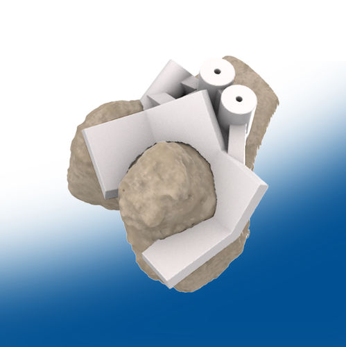 Plantilla de resección para prótesis de cadera - 3D - Ortho Baltic