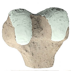 Modelo anatómico de rodilla - Ortho Baltic - quirúrgico