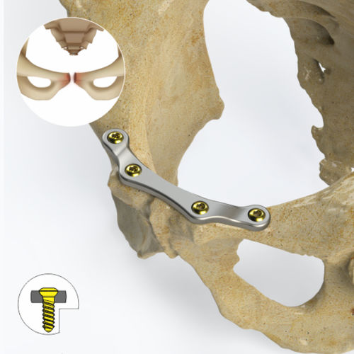 Placa de compresión para pelvis - 9742 series - Zimed Medical - bloqueada / metálica