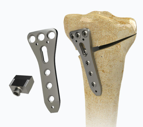Placa de osteotomía para tibia - 1972-0016 - Zimed Medical - porción proximal / porción medial / bloqueada